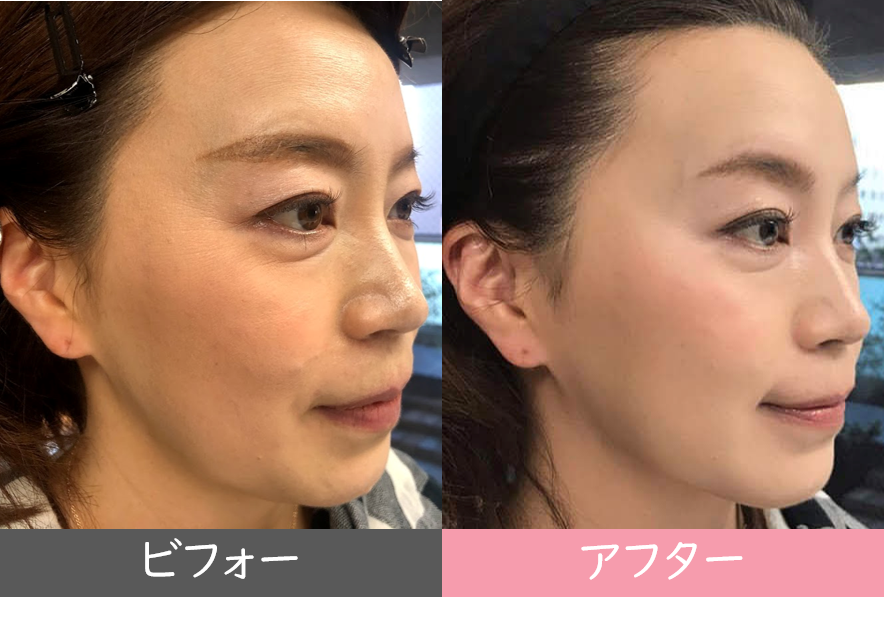 40代メイクレッスンのビフォーアフター