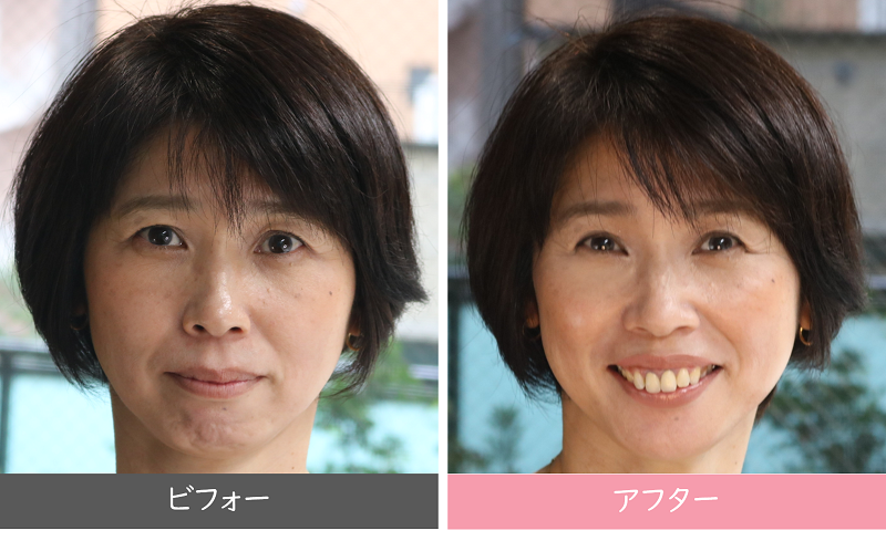 脱すっぴん！大人ツヤ肌メイク/40代50代、60代専門メイク＆眉サロンLADY GOレディゴー/横浜センター北