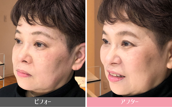 眉毛ビフォーアフター/美キャリアラボ平井聡子